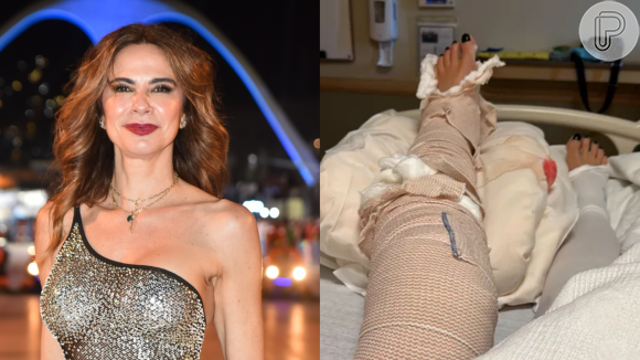 Luciana Gimenez sofreu um grave acidente enquanto esquiava nos Estados Unidos. A apresentadora fraturou a perna em quatro lugares diferentes
