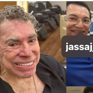 Cabeleireiro compartilhou o antes e depois de Silvio Santos, que pintou os cabelos e sobrancelhas de castanho