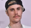 Nos últimos dias, passou a circular uma foto de Justin Bieber com os dentes aparentemente podres