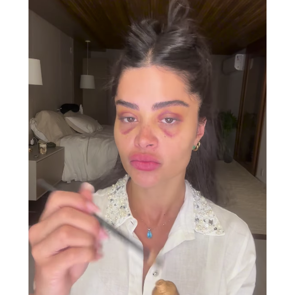 Aline Campos passou por um transplante de sobrancelhas e mostrou o resultado na web