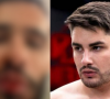 Ex de Lucas Souza detalha briga que terminou em agressão e exibe fotos do rosto ensanguentado
