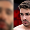 Ex de Lucas Souza detalha briga que terminou em agressão e exibe fotos do rosto ferido e ensanguentado