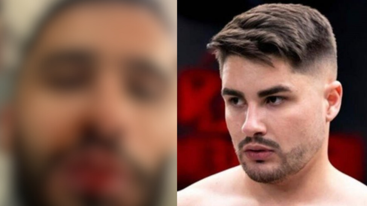 Ex de Lucas Souza detalha briga que terminou em agressão e exibe fotos do  rosto ferido e ensanguentado - Purepeople