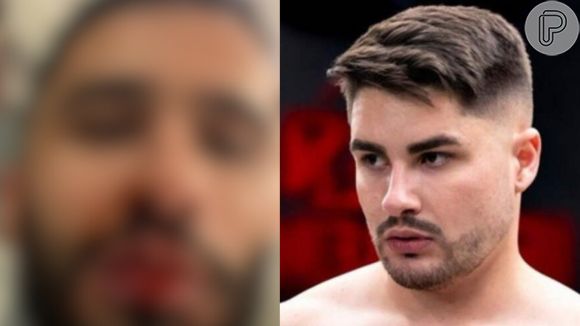Ex de Lucas Souza detalha briga que terminou em agressão e exibe fotos do rosto ensanguentado