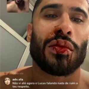 Laéllyo Mesquita postou uma foto do rosto ensanguentado na web