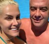 Após Ana Hickmann relançar marca, Alexandre Correa reclama no Instagram que também é sócio mas não foi consultado 