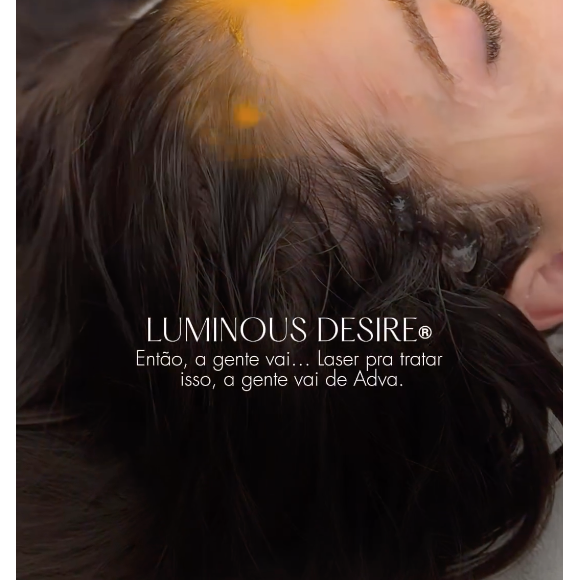 No rosto, Jade Picon utiliza o laser para controlar suas sardas e prevenir o melasma, além de promover a hidratação 