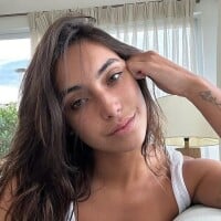 'Afeta minha autoestima': Vanessa Lopes mostra 'pele real' e desabafa sobre problemas com acne; médica explica como agir nestes casos