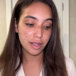 Vanessa Lopes disse que a condição afeta sua autoestima, mas é importante ser transparente nas redes sociais