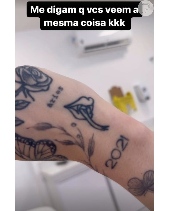 Karoline Lima também resolveu se desfazer de uma tatuagem na mão, de uma boca com língua de cobra