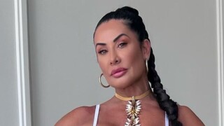 Antes e depois de Scheila Carvalho: dançarina remove preenchimentos do rosto e resultado impressiona. 'Estava irreconhecível'