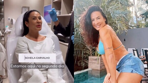 Antes e depois de Scheila Carvalho impressionou internautas e até a própria dançarina, que disse ter ficado chocada