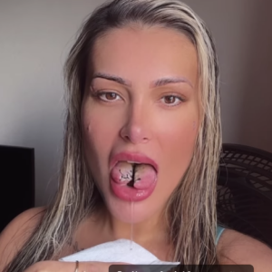 Andressa Urach chegou a revelar que salivou bastante, também, após a cirurgia bizarra de bifurcação da língua.