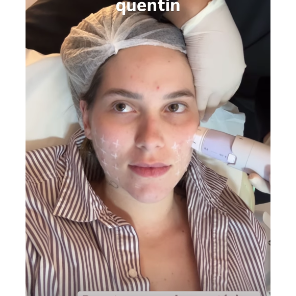 Tratamento de Virgínia Fonseca com Volnewmer foi realizado na clínica do dermatologista Alessandro Alarcao