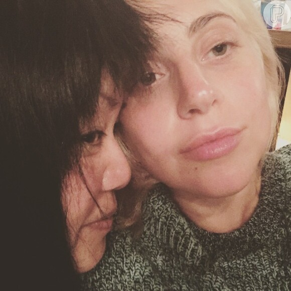 Lady Gaga queima couro cabeludo ao clarear os fios com água sanitária. Na foto postada em seu Instagram, ela aparece ao lado de sua cabeleireira Patti Song