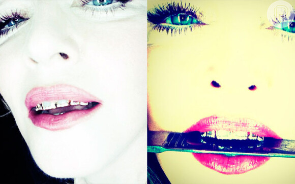 No início do mês, a rainha do pop, Madonna postou algumas fotos mostrando seus 'novos' dentes