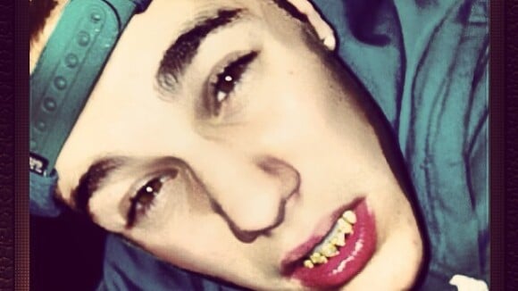 Justin Bieber, Rihanna, Madonna... Confira os famosos que usam dentes de ouro