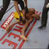 Anderson Silva fraturou a tíbia e a fíbula da perna esquerda na luta contra Chris Weidman pelo cinturão dos pesos-médios no UFC 168, em Las Vegas, no dia 28 de dezembro