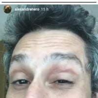 Alexandre Nero deixa bumbum à mostra em hospital: 'Não estou doente'