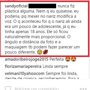 Sandy negou que tenha feito cirurgia no nariz após comentário no Instagram