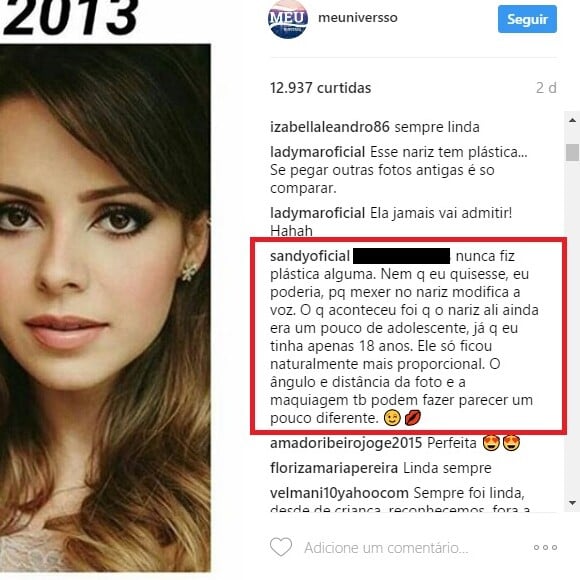 Sandy negou que tenha feito cirurgia no nariz após comentário no Instagram