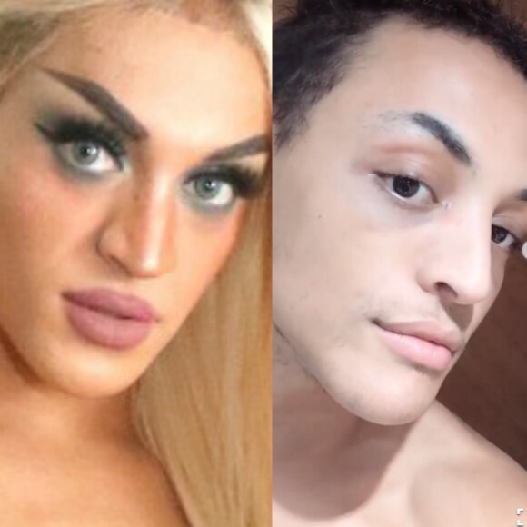 Pabllo Vittar mostra nariz após tirar curativos de cirurgia nesta segunda-feira, dia 26 de março de 2018