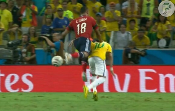 Com a pancada, Neymar sofreu uma fratura na região lombar