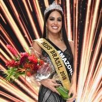 Miss Brasil passou por silicone, rinoplastia e clareamento dental para concurso