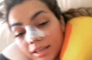 Kelly Key passa por cirurgias plásticas no nariz, seios e costas:'Está tudo bem'