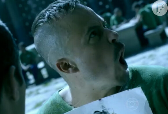Nas cenas da novela 'Império', Paulinho Vilhena exibe uma cicatriz na cabeça fruto de um implante de cabelo malsucedido
