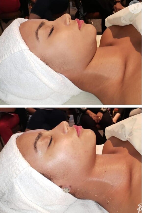 Veja antes e depois da Miracle Face, massagem desenvolvida por Renata França
