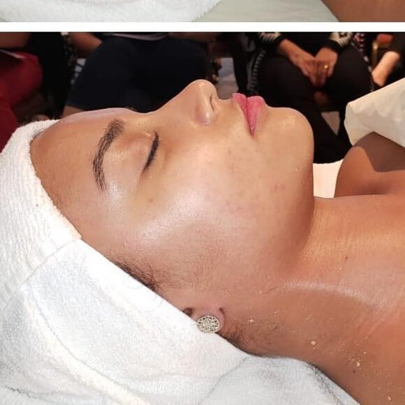 Veja antes e depois da Miracle Face, massagem desenvolvida por Renata França