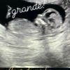Alok exibe ultrassom atual da gravidez de Romana Novais