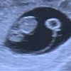 Alok mostra ultrassom do início da gravidez no Instagram