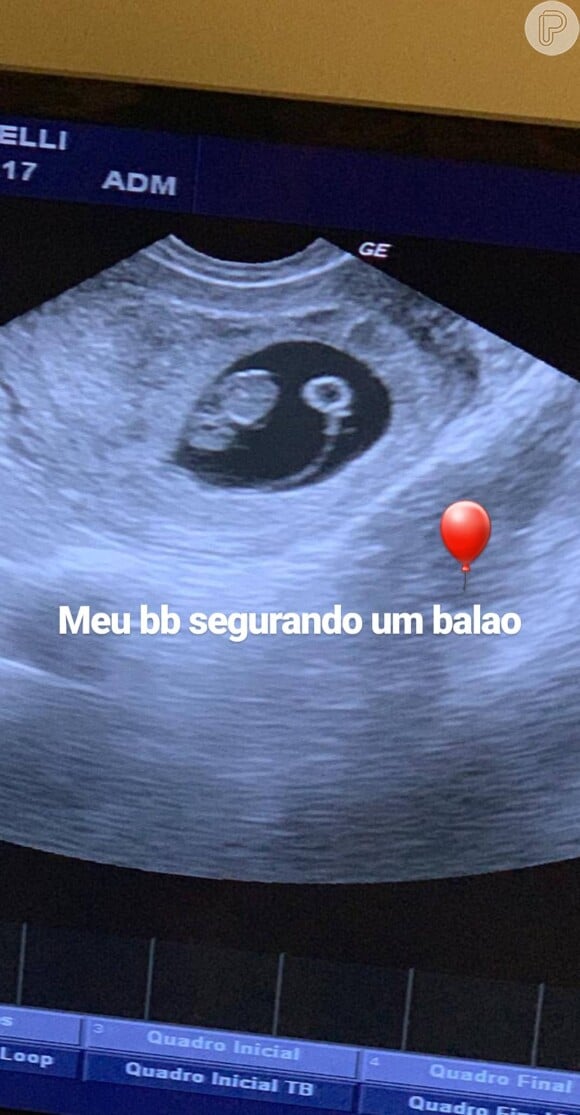 Alok mostra ultrassom do início da gravidez no Instagram