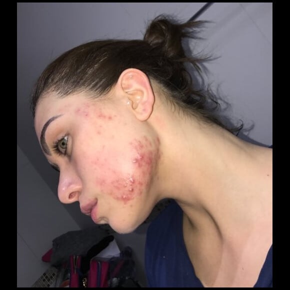 'Sem make, dava pra ver o quanto estava crítica a situação', diz Flavia Pavanelli