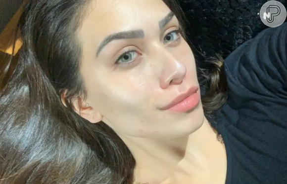 Flavia Pavanelli mostra rosto atualmente, após tratamento contra espinhas