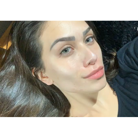 Flavia Pavanelli mostra rosto atualmente, após tratamento contra espinhas