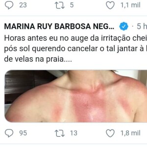 Marina Ruy Barbosa mostra marca de biquíni pós insolação