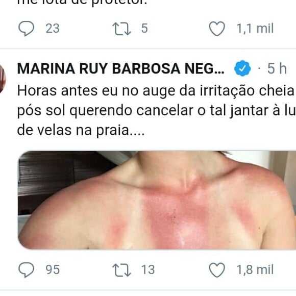 Marina Ruy Barbosa mostra marca de biquíni pós insolação