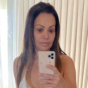 Solange Almeida fez bariátrica em 2008 e apontou mudanças notadas não só no corpo