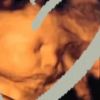 Sthefany Brito, no final da gravidez, chamou atenção dos fãs pelas bochechas do filho em ultrassom