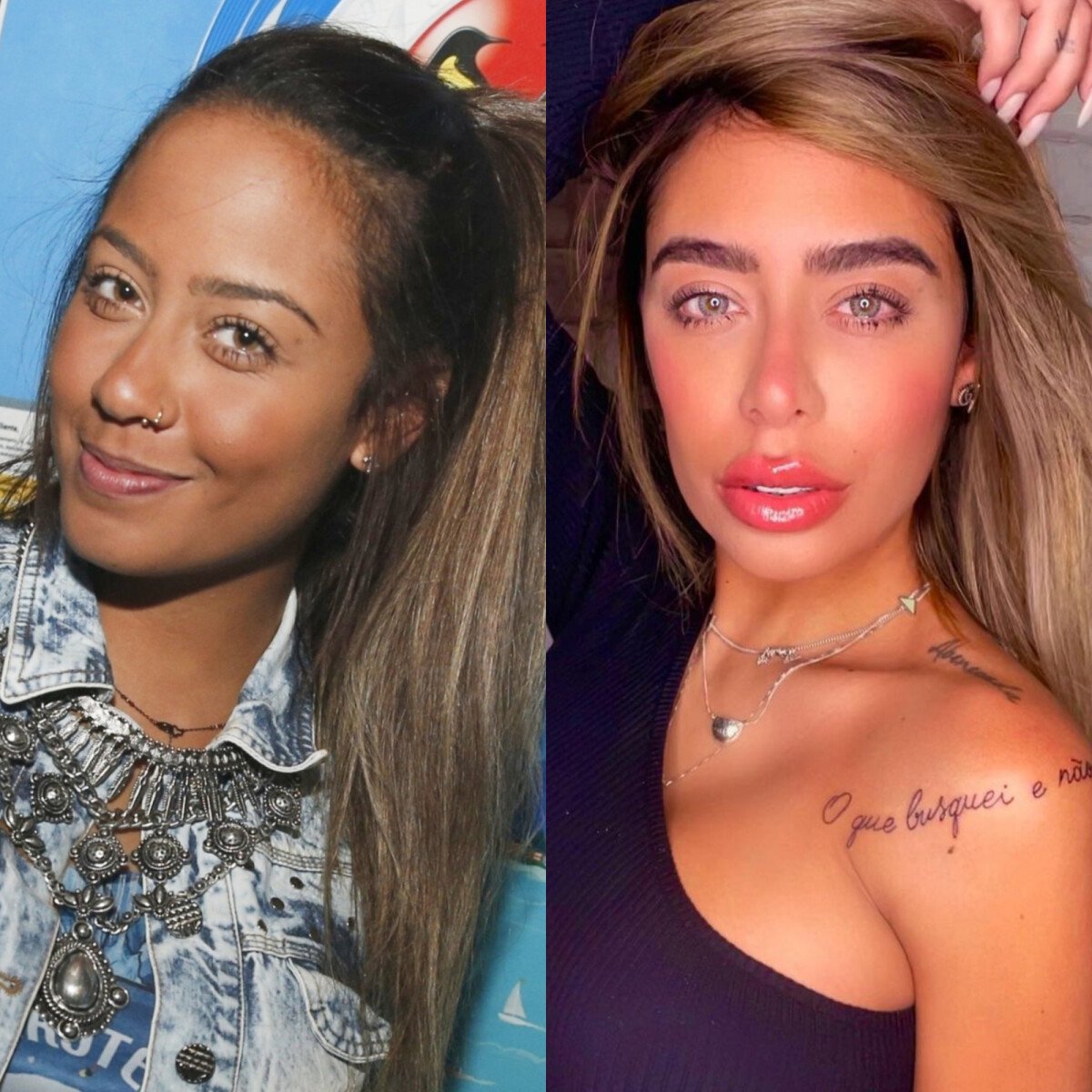 Foto Rafaella Santos Aposta Na Harmoniza O Facial E D Repaginada No Visual Purepeople