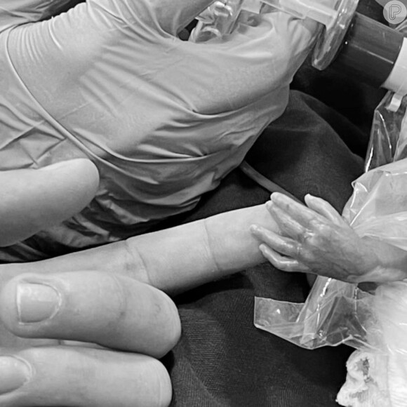 Filho de Whindersson Nunes e Maria Lina nasceu de forma prematura de 22 semanas