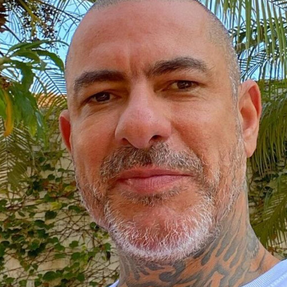 Henrique Fogaça leve 8 pontos na cabeça e detalha acidente no 'MasterChef': 'Caiu a pressão'