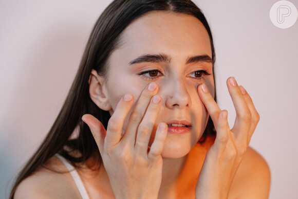 Manchas no rosto podem ser tratadas com o uso do ácido kójico no verão