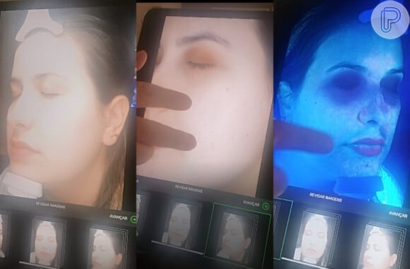 Diferentes aspectos da pele são analisados em três passos com o Skin Screen