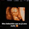 Grávida do primeiro filho, MC Loma fez uma nova ultrassonografia do bebê
