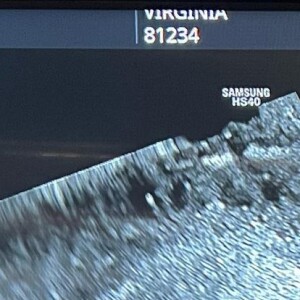 Virgínia Fonseca grávida de um menino? 71% dos seguidores da influencer acham que sim! Veja foto da primeira ultrassom do bebê, realizada em março