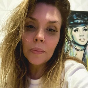 Simony foi diagnosticada com a doença no mesmo dia em que a ex-BBB Aline Gotschalg revelou o câncer na tireoide